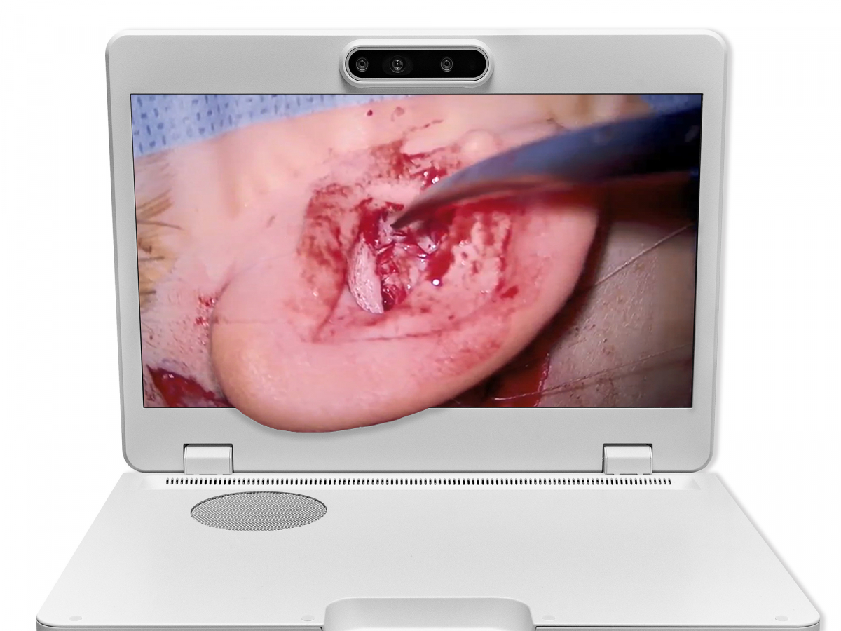 达擎之＂Heads-up 3D显微手术显示系统＂，整合4K裸眼3D显示及眼球追踪系统，具备快速追踪人眼移动位置功能，减轻医师长时间维持固定姿势的负担，让医师能有更宽广清晰的3D立体视野及更舒适的姿势来执行手术。